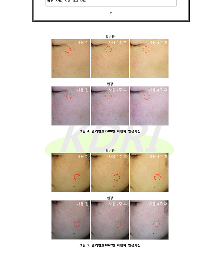 루치온-백옥-상세페이지_17.jpg