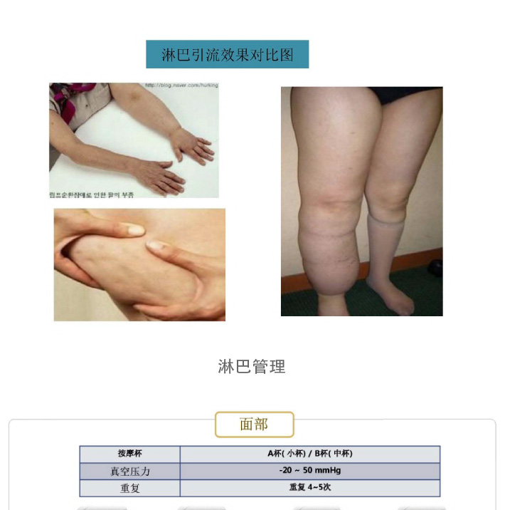 진공마사지기-CN_06.jpg